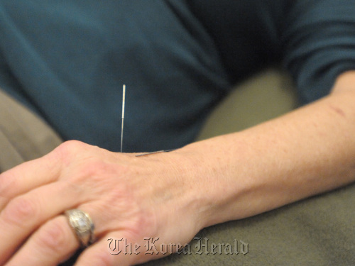 Fred Wolfson, owner of “Acupuncture For All” treats several patients at a time in a peaceful, communal room, which keeps the costs down from what a normal acupuncture procedure costs.  Gene Sweeney Jr./Baltimore Sun/MCT