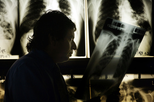 Dr. David Ashkin, a pulmonary specialist with a research interest in tuberculosis, examines a chest
X-ray at A.G. Holley State Hospital in Florida. (Bloomberg)
