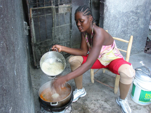 Sounlove Zamor, 20, who lost both legs below the knee in Haiti’s
earthquake, received prosthetic legs in Israel but faces a difficult
life back at home in Port-au-Prince. (Los Angeles Times/MCT)
