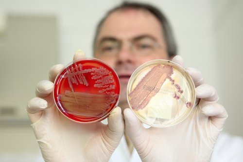 Helmut Fickenscher, director of the institute for infection medicine at the university clinic of Schleswig-Holstein, holds petri dishes with colonies of the virulent E.coli bacteria on Wednesday at the insitute’s laboratory in Kiel, northern Germany. (AFP-Yonhap News)