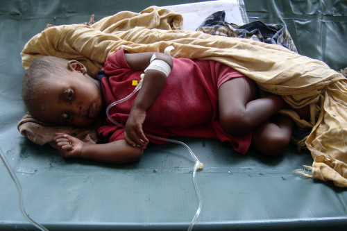 <YONHAP PHOTO-2159> A malnourished child from southern Somalia lies on bed at Banadir hospital, Mogadishu, Somalia, Saturday, July 9, 2011, after fleeing from southern Somalia. Thousands of people have arrived in Mogadishu over the past two weeks seeking assistance and the number is increasing by the day, due to lack of water and food. The worst drought in the Horn of Africa has sparked a severe food crisis and high malnutrition rates, with parts of Kenya and Somalia experiencing pre-famine conditions, the United Nations has said. More than 10 million people are now affected in drought-stricken areas of Djibouti, Ethiopia, Kenya, Somalia and Uganda and the situation is deteriorating, (AP Photo/Farah Abdi Warsameh)/2011-07-09 22:20:02/ <저작권자 ⓒ 1980-2011 ㈜연합뉴스. 무단 전재 재배포 금지.>
A malnourished child from southern Somalia lies in a hospital on Saturday. AP-Yonhap News