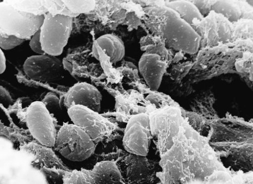 Undated handout image provided by Rocky Mountain Laboratories showing an electron micrograph depicting a mass of Yersinia pestis bacteria (the cause of bubonic plague). (AP-Yonhap News)