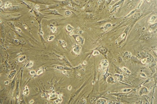 Embryonic stem cells are pictured through a microscope viewfinder in a laboratory, in 2008. (AFP)