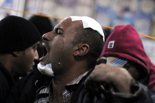 <YONHAP PHOTO-0289> A wounded Egyptian protester shouts at a field hospital following clashes with security forces in Cairo on November 20, 2011. Deadly clashes broke out at Cairo's Tahrir Square for the second day running, kicking off a violent countdown to the first elections since Hosni Mubarak's downfall. AFP PHOTO/MOHAMMED HOSSAM /2011-11-21 03:42:41/ <저작권자 ⓒ 1980-2011 ㈜연합뉴스. 무단 전재 재배포 금지.>\r\n<YONHAP PHOTO-0289> A wounded Egyptian protester shouts at a field hospital following clashes with security forces in Cairo on November 20, 2011. Deadly clashes broke out at Cairo's Tahrir Square for the second day running, kicking off a violent countdown to the first elections since Hosni Mubarak's downfall. AFP PHOTO/MOHAMMED HOSSAM /2011-11-21 03:42:41/ <저작권자 ⓒ 1980-2011 ㈜연합뉴스. 무단 전재 재배포 금지.>