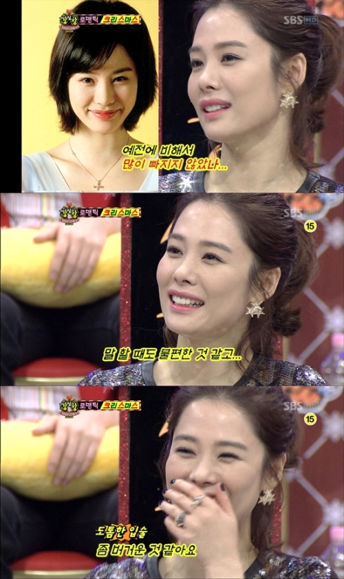 sbs 강심장/ 김현주 “콤플렉스인 ‘도톰한 입술’ 예전보다 축소됐다” 고백