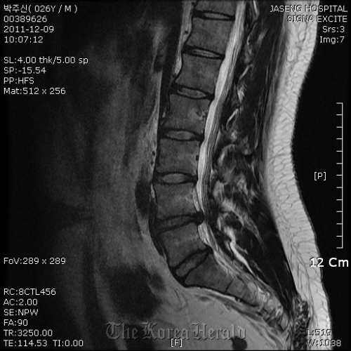 An alleged MRI scan film of Park Ju-sin Courtesy of Kang Yong-seok