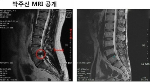 박원순 시장 아들 MRI “비만 체형의 30~40대”