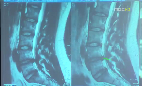 강용석, 강용석 법률사무소 (변호사), 지식경제위원회 (위원)/박원순 아들 MRI 재검…“MRI 본인 것 맞다”