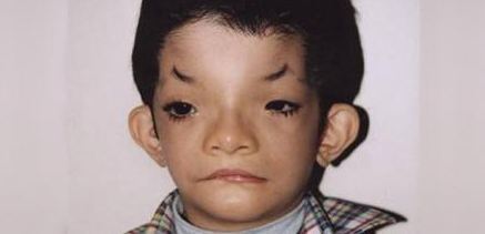 희귀질병 유전자 발견, 주요질병 완치길 열리나?