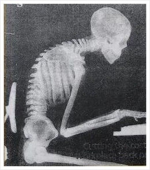 지금 당신의 자세