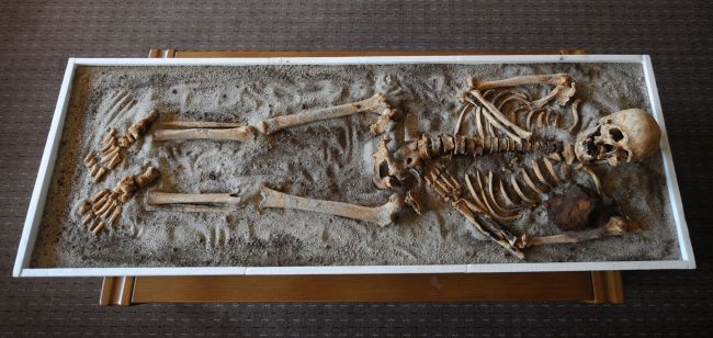 This picture taken on Thursday shows a skeleton with an iron piece before being exposed at the National History museum in Sofia. (AFP-Yonhap News)