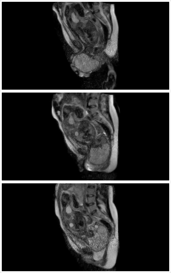 출산 순간 기록한 MRI 최초 공개…“경이롭다”