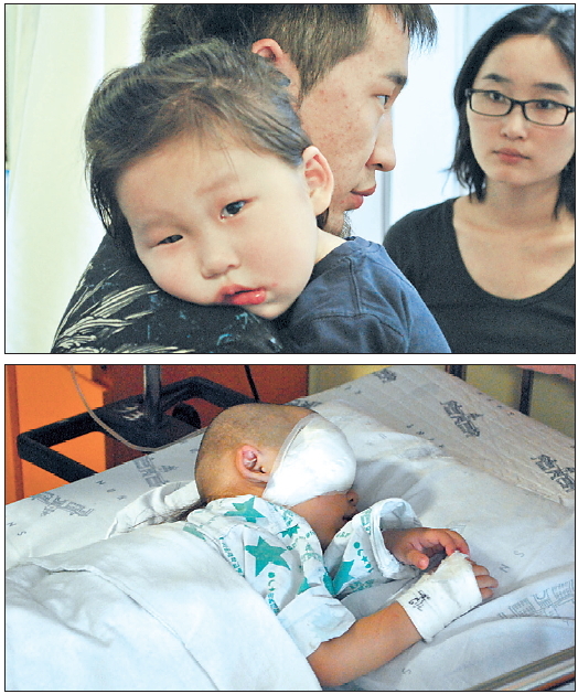 Khatanbaatar Ariuntulga recovers from a surgery to remove cancer in his right eye at Seoul National University Hospital Friday (below photo). He is in his father’s arms after undergoing diagnosis
Tuesday. (Yonhap News)