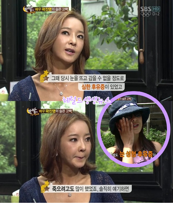 곽진영, 탤런트, 영화배우/ 곽진영 “성형후유증, 솔직히 얘기하면…”