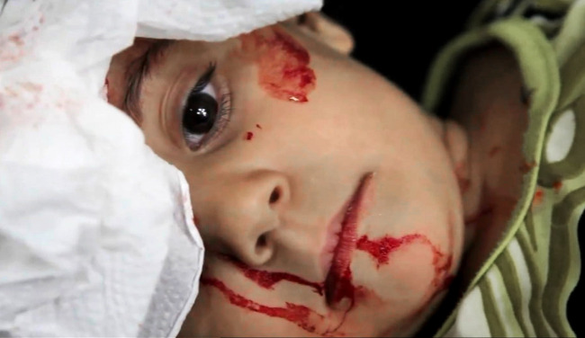 <YONHAP PHOTO-2166> This image taken from video filmed by an independent cameraman and made available on Monday, Sept. 3, 2012 shows a Syrian wounded child at the Dar al-Shifa hospital, in Aleppo, Syria. Grief stricken parents tried desperately to calm their injured children as the doctors at the Dar al-Shifa hospital struggled to treat an influx of injured in a mortar attack. Local residents say the attack was launched by Syrian government forces onto a densely populated area of the city on Monday. (AP Photo/APTN)/2012-09-05 22:56:36/ <저작권자 ⓒ 1980-2012 ㈜연합뉴스. 무단 전재 재배포 금지.>
This image taken from video filmed by an independent cameraman and made available on Monday shows a wounded Syrian child at the Dar al-Shifa hospital, in Aleppo, Syria.   AP-Yonhap News