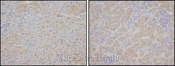 Photographs showing the differences in healthy (left) and cancerous liver tissue stained to show Romo 1 proteins.
Ministry of Education, Science and Technoloy