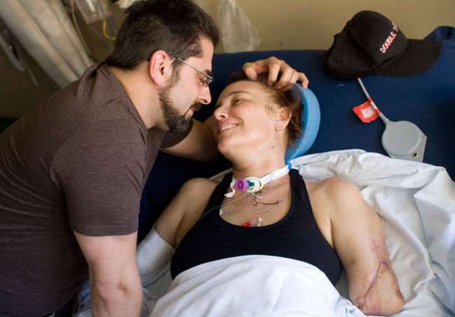 Quadruple amputee Katy Hayes smiles up at her husband Al in a Dallas hospital. (AP)