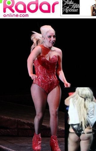 레이디 가가(Lady GaGa/가수)
살찐 레이디가가…탄탄한 허벅지는 어디로 ‘충격’