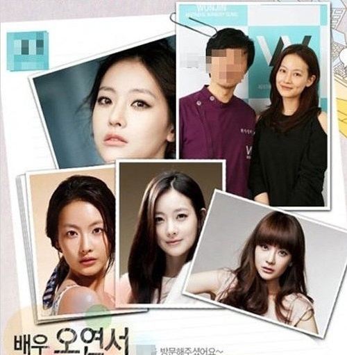 오연서(배우)
오연서, 성형 안했다더니…하루만에 성형외과 인증샷?