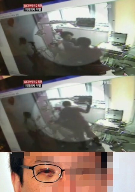 환자를 폭행하는 장면이 담긴 YTN 영상 캡처(위)와 치과의사가 올린 폭행당한 얼굴.