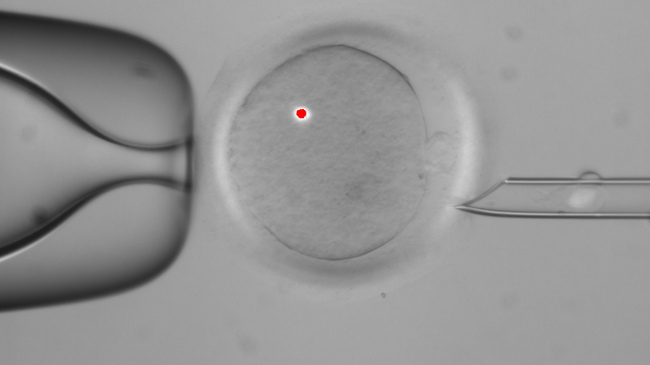 <YONHAP PHOTO-0283> In this image made available by the Oregon Health & Science University, a faint white blotch in the tube at right is DNA that has been removed from a human egg, center. The red dot is from a laser used in the procedure. Scientists have successfully transplanted DNA between human eggs and grown them into early embryos. Someday that technique that may let children avoid inheriting certain diseases - and give them genes from another woman besides Mom. (AP Photo/Oregon Health & Science University)/2012-10-25 05:59:03/ <저작권자 ⓒ 1980-2012 ㈜연합뉴스. 무단 전재 재배포 금지.>
A faint white blotch in the tube at right is DNA that has been removed from a human egg (center). The red dot is from a laser used in the procedure. Scientists have successfully transplanted DNA between human eggs and grown them into early embryos. Someday that technique that may let children avoid inheriting certain diseases ― and give them genes from another woman besides Mom.   AP-Yonhap News