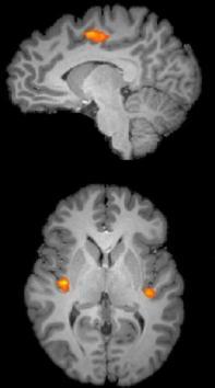 Researchers say the higher a person’s anxiety about math, the more anticipating math activated areas of the brain related to experiencing pain. Credit: Sian Beilock (UPI)
