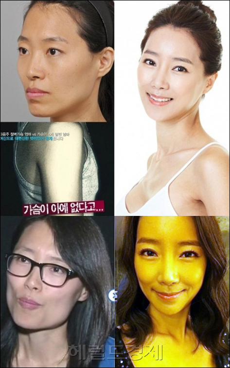 박화성(화제인물)
37세 주부인 박화성씨는 ‘렛미인2’에서 한 때 연예인 뺨치는 외모를 자랑했지만 출산 후 모유수유로 노안에 절벽 가슴으로 변해버린 안타까운 사연을 들고 나와 성형 수술 후 페이스오프에 성공한 화제의 주인공이다.