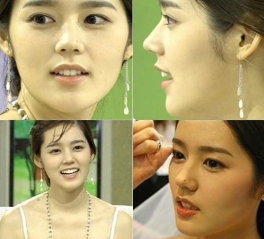 한가인(김현주/배우)
최근 한 온라인 커뮤니티 게시판에는 ‘말도 안되는 한가인 7년전 미모’라는 제목의 사진들이 공개됐다.
공개된 사진은 한가인의 7년 전 모습이 담긴 것으로 사진 속에서 한가인은 백옥같은 피부와 또렷한 이목구비를 자랑하고 있다.