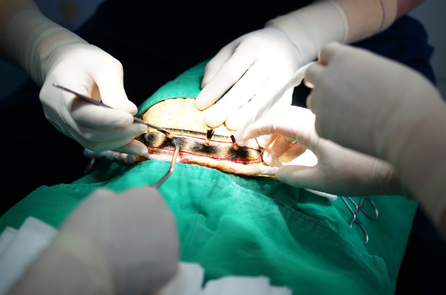 Dr. Ock Kun conducts a hair transplant surgery using OKT, a newly developed device that improves hair survival rate.
(Ock Kun Hair Transplant Center)