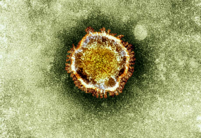 This undated image released by the British Health Protection Agency shows an electron microscope image of a coronavirus, part of a family of viruses that cause ailments including the common cold and SARS, which was first identified last year in the Middle East.   AP