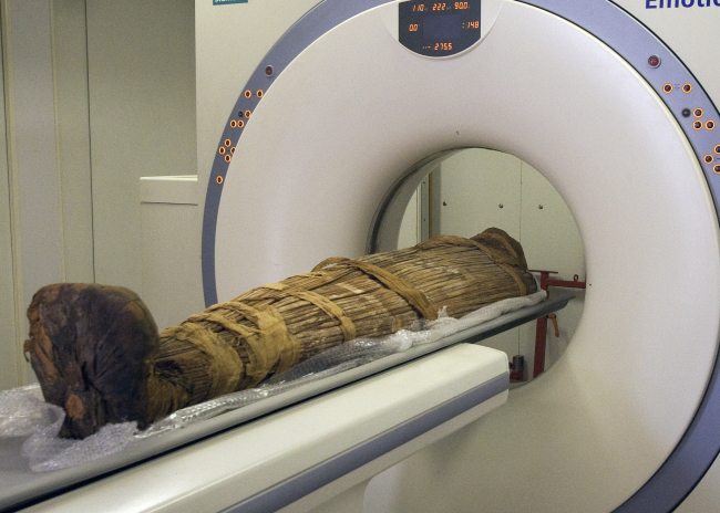 <YONHAP PHOTO-0312> In this undated photo released Sunday March 10, 2013, by a group of cardiologists lead by Saint Luke?s Mid America Heart Institute in Kansas City, USA, showing The mummy Hatiay (New Kingdom, 18th Dynasty, 1550 to 1295 BCE) being scanned in CAiro, Egypt, where it was found to have evidence of extensive vascular disease by CT scanning. This scanning is part of a major survey to investigate some 137 mummies which has revealed that people probably had clogged arteries and heart disease some 4,000 years ago. CT scans of 137 mummies showed evidence of atherosclerosis, or hardened arteries, in one third of those examined, including those from ancient people believed to have healthy lifestyles. (AP Photo/Dr. Michael Miyamoto)/2013-03-11 09:21:03/ <저작권자 ⓒ 1980-2013 ㈜연합뉴스. 무단 전재 재배포 금지.>
The mummy Hatiay is scanned in Cairo, Egypt, Sunday.   AP-Yonhap News