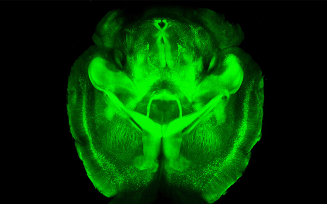 <YONHAP PHOTO-0236> This undated image provided by Karl Deisseroth's lab shows a three-dimensional rendering of clarified mouse brain seen from below. Scientists have made mouse brains transparent, permitting a comprehensive and exquisitely detailed view of their inner structures, providing a major new tool for research. "You get the big picture without losing track of the details,'' said Dr. Karl Deisseroth, who led the Stanford team that reported the work online Wednesday, April 10, 2013 in the journal Nature. Some other labs are already working to apply the technique on other kinds of tissue, such as for studying breast cancer biopsies, Deisseroth said. (AP Photo/Karl Deisseroth)/2013-04-11 05:22:29/ <저작권자 ⓒ 1980-2013 ㈜연합뉴스. 무단 전재 재배포 금지.>
This undated image provided by Karl Deisseroth’s lab shows a three-dimensional rendering of clarified mouse brain seen from below.   AP-Yonhap News