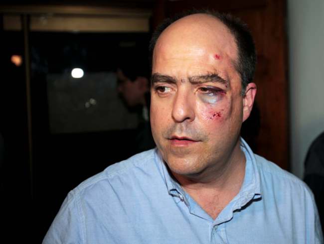 Opposition lawmaker Julio Borges arrives with a bruised face to his political party’s headquarters before speaking to the press in Caracas on Tuesday.   AP-Yonhap News