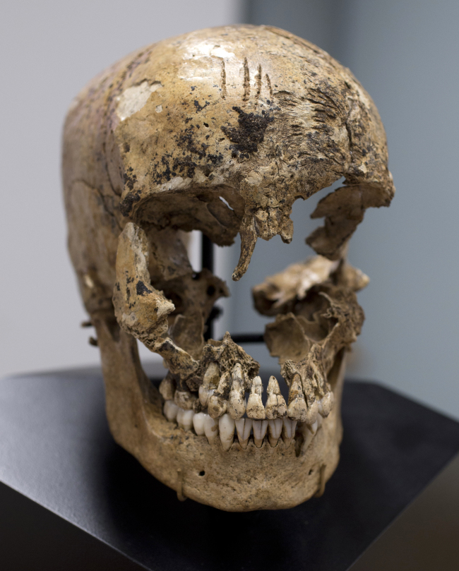<YONHAP PHOTO-0260> Strike marks are seen on the skull of "Jane of Jamestown" during a news conference at the Smithsonian's National Museum of Natural History in Washington, Wednesday, May 1, 2013. Scientists announced during the news conference that they have found the first solid archaeological evidence that some of the earliest American colonists at Jamestown, Va., survived harsh conditions by turning to cannibalism presenting the discovery of the bones of a 14-year-old girl, "Jane" that show clear signs that she was cannibalized. (AP Photo/Carolyn Kaster)/2013-05-02 05:59:15/ <저작권자 ⓒ 1980-2013 ㈜연합뉴스. 무단 전재 재배포 금지.>
Strike marks on the skull (left) and a facial reconstruction (right) of “Jane of Jamestown” are seen during a news conference at the Smithsonian’s National Museum of Natural History in Washington on Wednesday.
AP-Yonhap News