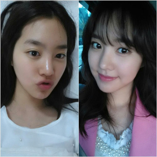 진세연(탤런트)
2일 한 온라인 커뮤니티 게시판에는 진세연의 화장 전후를 비교한 사진이 올라왔다.