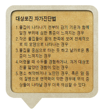 우리나라 성인의 대부분은 수두 바이러스를 가지고 있어 면역력이 약해질 때 대상포진이 걸릴 수 있다. 평소 스트레스를 줄이고 운동 등을 통해 면역력을 강화시키는 습관이 필요하다.