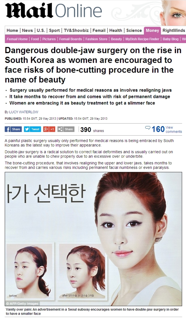 예쁜 턱선을 위해 부작용이 큰 위험한 양악수술을 감행하는 여성인구가 한국에서 점점 늘고 있다고 영국 일간지 데일리메일이 30일(현지시간) 보도했다.