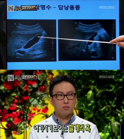 박명수(MC/가수)
개그맨 박명수에게 담낭용종이 발견돼 시청자들을 놀라게 했다.