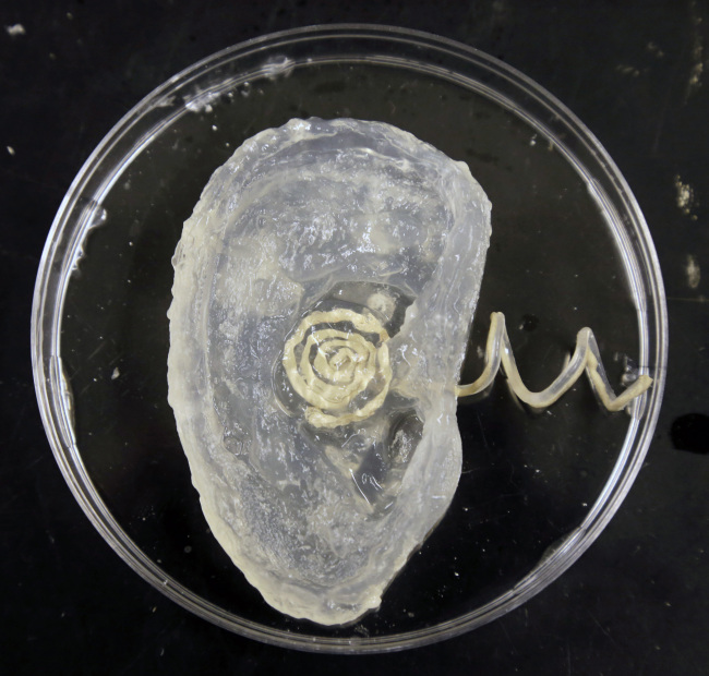 A bionic ear rests in a petri dish.
AP-Yonhap News