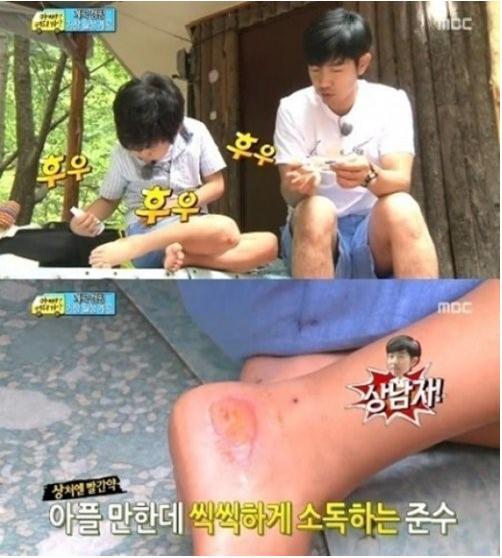 이준수(좌부터/이종혁아들),이종혁(영화배우/탤런트)
8일 이종혁은 자신의 트위터에 “준수 발 다쳤던 건 거의 다 나았어요. 처음에는 좀 많이 심했죠. 부위가 넓고 깊어 진물도 많이 나서 자주 갈아줘야 했지만 걱정해주셔서 감사”라는 글을 게재했다.