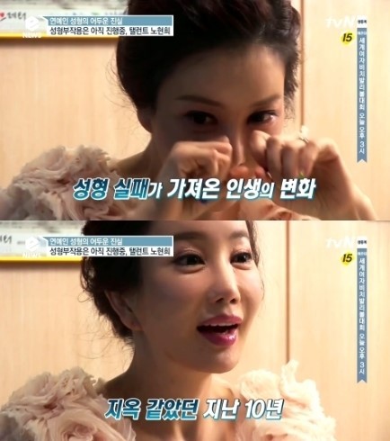 노현희(탤런트/뮤지컬배우)
배우 노현희가 성형 수술을 언급하며 눈물을 흘렸다.