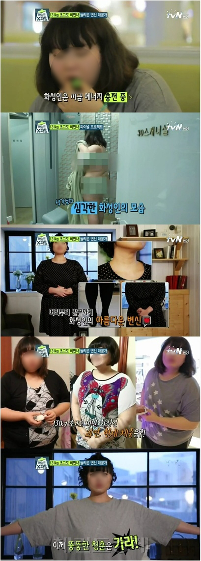 화성인 초고도비만녀 사망 소식이 전해지며 위밴드 수술에 대한 관심도 높아지고 있다.