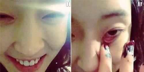 아름(이아름/가수)
최근 SNS에 괴이한 글과 섬뜩한 사진·영상 등을 잇따라 올려 논란이 됐던 티아라의 전 멤버 아름이 또 다시 의미심장한 글을 올렸다.