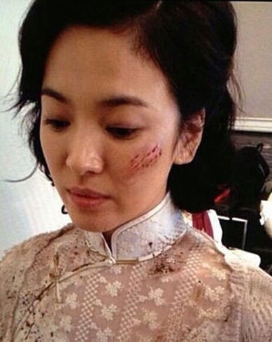 송혜교(탤런트/영화배우)
배우 송혜교의 상처분장이 화제다.