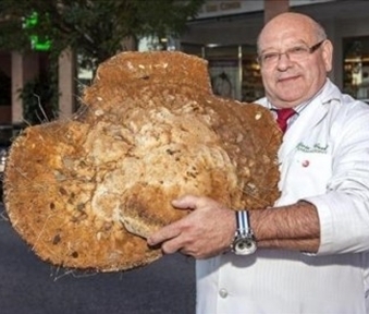 12kg 자이언트 버섯이 공개됐다.　
스페인 현지 언론은 지난 1일(현지시각) “가을을 맞아 버섯을 따러 나간 한 약사가 자이언트 버섯을 발견해 약국에 전시 중 이다”라고 보도했다.　
보도에 따르면 약사가 발견한 이 버섯은 ‘시루뻔버섯’으로 지름 65cm 이상으로 자랄 수도 있다고 하지만 실제로 자이언트 크기가 발견되는 경우는 드물다.