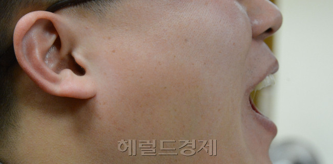 턱관절<br />정희조 기자/checho@heraldcorp.com 131227
턱관절
정희조 기자/checho@heraldcorp.com 131227
턱관절
정희조 기자/checho@heraldcorp.com 131227