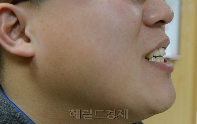 턱관절<br />정희조 기자/checho@heraldcorp.com 131227
턱관절
정희조 기자/checho@heraldcorp.com 131227
턱관절
정희조 기자/checho@heraldcorp.com 131227
