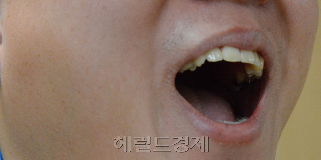 턱관절<br />정희조 기자/checho@heraldcorp.com 131227
턱관절
정희조 기자/checho@heraldcorp.com 131227
턱관절
정희조 기자/checho@heraldcorp.com 131227
