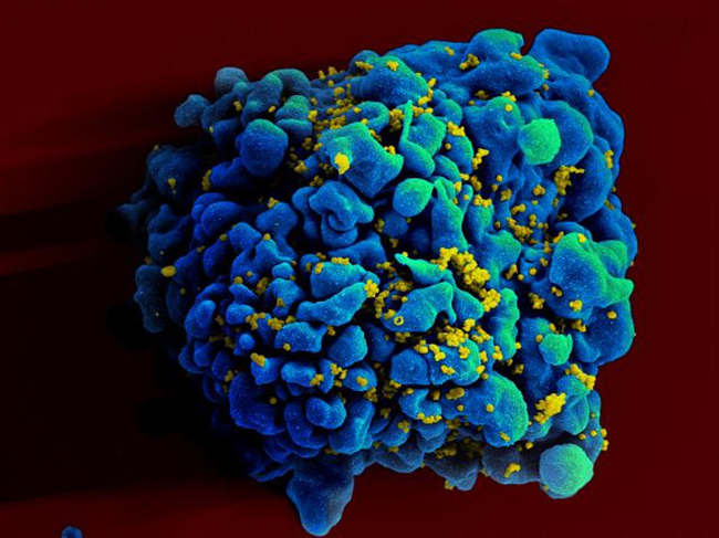 This electron microscope image shows an H9 T-cell infected with the human immunodeficiency virus.   AP-Yonhap