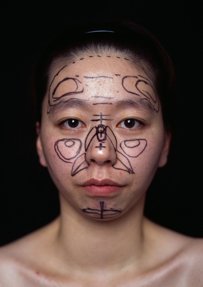 “On Plastic Surgery #01” by Lee Seung-hoon. Sungkok Art Museum